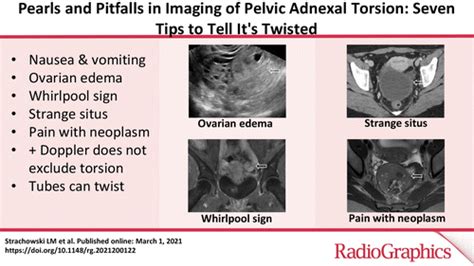 diagnostic test for ovarian torsion|ovarian torsion vs appendicitis.